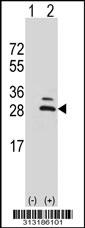 Western blot analysis of his-tag C9orf24 (arrow) using his tag antibody. 293 cell lysates (2 ug/lane) either nontransfected (Lane 1) or transiently transfected with the C9orf24 gene