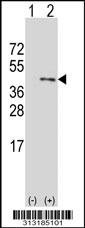 Western blot analysis of his-tag THAP10 (arrow) using his tag antibody. 293 cell lysates (2 ug/lane) either nontransfected (Lane 1) or transiently transfected with the THAP10 gene