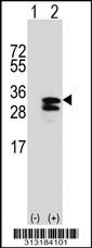 Western blot analysis of his-tag PACRG (arrow) using his tag antibody. 293 cell lysates (2 ug/lane) either nontransfected (Lane 1) or transiently transfected with the PACRG gene