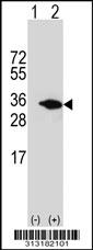 Western blot analysis of his-tag NR0B2 (arrow) using his tag antibody. 293 cell lysates (2 ug/lane) either nontransfected (Lane 1) or transiently transfected with the NR0B2 gene