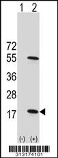 Western blot analysis of his-tag RAB34 (arrow) using his tag antibody. 293 cell lysates (2 ug/lane) either nontransfected (Lane 1) or transiently transfected with the RAB34 gene