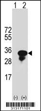 Western blot analysis of his-tag TPM4 (arrow) using his tag antibody. 293 cell lysates (2 ug/lane) either nontransfected (Lane 1) or transiently transfected with the TPM4 gene