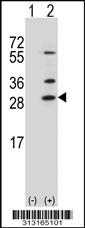 Western blot analysis of his-tag C4orf18 (arrow) using his tag antibody. 293 cell lysates (2 ug/lane) either nontransfected (Lane 1) or transiently transfected with the C4orf18 gene