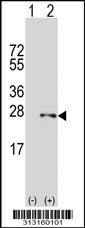 Western blot analysis of his-tag DECR2 (arrow) using his tag antibody. 293 cell lysates (2 ug/lane) either nontransfected (Lane 1) or transiently transfected with the DECR2 gene