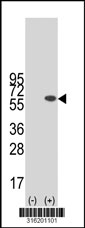 Western blot analysis of his-tag BAG5 (arrow) using his tag antibody. 293T cell lysates (2 ug/lane) either nontransfected (Lane 1) or transiently transfected with the BAG5 gene‘