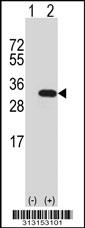 Western blot analysis of his-tag STX8 (arrow) using his tag antibody. 293 cell lysates (2 ug/lane) either nontransfected (Lane 1) or transiently transfected with the STX8 gene