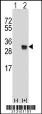 Western blot analysis of his-tag TFPI2 (arrow) using his tag antibody. 293 cell lysates (2 ug/lane) either nontransfected (Lane 1) or transiently transfected with the TFPI2 gene