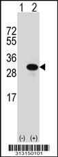 Western blot analysis of his-tag FAM76B (arrow) using his tag antibody. 293 cell lysates (2 ug/lane) either nontransfected (Lane 1) or transiently transfected with the FAM76B gene