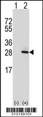 Western blot analysis of his-tag RNF125 (arrow) using his tag antibody. 293 cell lysates (2 ug/lane) either nontransfected (Lane 1) or transiently transfected with the RNF125 gene