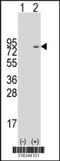Western blot analysis of his-tag MYT1 (arrow) using his tag antibody. 293T cell lysates (2 ug/lane) either nontransfected (Lane 1) or transiently transfected with the MYT1 gene‘