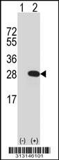 Western blot analysis of his-tag LYPLA1 (arrow) using his tag antibody. 293 cell lysates (2 ug/lane) either nontransfected (Lane 1) or transiently transfected with the LYPLA1 gene