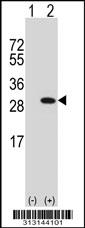 Western blot analysis of his-tag UCHL3 (arrow) using his tag antibody. 293 cell lysates (2 ug/lane) either nontransfected (Lane 1) or transiently transfected with the UCHL3 gene