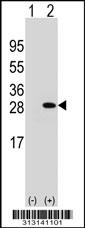 Western blot analysis of his-tag MOBKL3 (arrow) using his tag antibody. 293 cell lysates (2 ug/lane) either nontransfected (Lane 1) or transiently transfected with the MOBKL3 gene