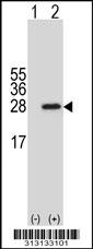 Western blot analysis of his-tag FAM3A (arrow) using his tag antibody. 293 cell lysates (2 ug/lane) either nontransfected (Lane 1) or transiently transfected with the FAM3A gene