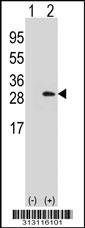 Western blot analysis of his-tag C22orf23 (arrow) using his tag antibody. 293 cell lysates (2 ug/lane) either nontransfected (Lane 1) or transiently transfected with the C22orf23 gene