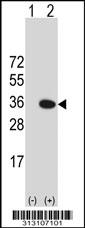 Western blot analysis of his-tag STX11 (arrow) using his tag antibody. 293 cell lysates (2 ug/lane) either nontransfected (Lane 1) or transiently transfected with the STX11 gene