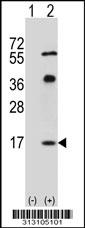 Western blot analysis of his-tag COX6A2 (arrow) using his tag antibody. 293 cell lysates (2 ug/lane) either nontransfected (Lane 1) or transiently transfected with the COX6A2 gene
