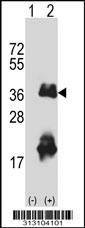 Western blot analysis of his-tag C12orf53 (arrow) using his tag antibody. 293 cell lysates (2 ug/lane) either nontransfected (Lane 1) or transiently transfected with the C12orf53 gene