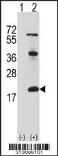 Western blot analysis of his-tag HMGN3 (arrow) using his tag antibody. 293 cell lysates (2 ug/lane) either nontransfected (Lane 1) or transiently transfected with the HMGN3 gene