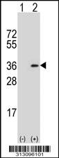 Western blot analysis of his-tag UGCGL2 (arrow) using his tag antibody. 293 cell lysates (2 ug/lane) either nontransfected (Lane 1) or transiently transfected with the UGCGL2 gene