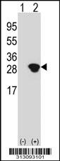 Western blot analysis of his-tag GSTM4 (arrow) using his tag antibody. 293 cell lysates (2 ug/lane) either nontransfected (Lane 1) or transiently transfected with the GSTM4 gene