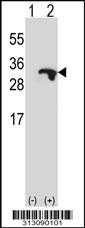 Western blot analysis of his-tag C19orf36 (arrow) using his tag antibody. 293 cell lysates (2 ug/lane) either nontransfected (Lane 1) or transiently transfected with the C19orf36 gene