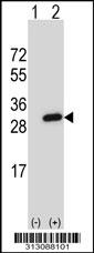 Western blot analysis of his-tag RAB5A (arrow) using his tag antibody. 293 cell lysates (2 ug/lane) either nontransfected (Lane 1) or transiently transfected with the RAB5A gene