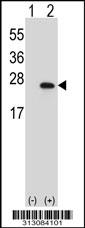 Western blot analysis of his-tag TIMP3 (arrow) using his tag antibody. 293 cell lysates (2 ug/lane) either nontransfected (Lane 1) or transiently transfected with the TIMP3 gene