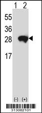 Western blot analysis of his-tag ABHD14B (arrow) using his tag antibody. 293 cell lysates (2 ug/lane) either nontransfected (Lane 1) or transiently transfected with the ABHD14B gene
