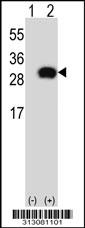 Western blot analysis of his-tag SNAP23 (arrow) using his tag antibody. 293 cell lysates (2 ug/lane) either nontransfected (Lane 1) or transiently transfected with the SNAP23 gene