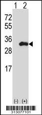 Western blot analysis of his-tag RERG (arrow) using his tag antibody. 293 cell lysates (2 ug/lane) either nontransfected (Lane 1) or transiently transfected with the RERG gene