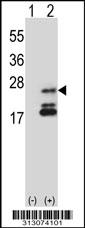 Western blot analysis of his-tag OSTalpha (arrow) using his tag antibody. 293 cell lysates (2 ug/lane) either nontransfected (Lane 1) or transiently transfected with the OSTalpha gene