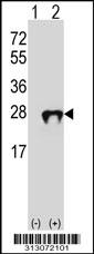 Western blot analysis of his-tag RAC2 (arrow) using his tag antibody. 293 cell lysates (2 ug/lane) either nontransfected (Lane 1) or transiently transfected with the RAC2 gene