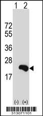 Western blot analysis of his-tag PLA2G12A (arrow) using his tag antibody. 293 cell lysates (2 ug/lane) either nontransfected (Lane 1) or transiently transfected with the PLA2G12A gene
