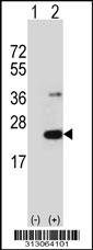 Western blot analysis of his-tag C3orf24 (arrow) using his tag antibody. 293 cell lysates (2 ug/lane) either nontransfected (Lane 1) or transiently transfected with the C3orf24 gene