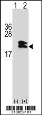 Western blot analysis of his-tag TNNC1 (arrow) using his tag antibody. 293 cell lysates (2 ug/lane) either nontransfected (Lane 1) or transiently transfected with the TNNC1 gene