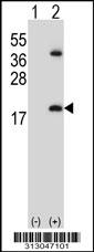 Western blot analysis of his-tag RNF7 (arrow) using his tag antibody. 293 cell lysates (2 ug/lane) either nontransfected (Lane 1) or transiently transfected with the RNF7 gene
