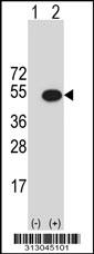 Western blot analysis of his-tag REM2 (arrow) using his tag antibody. 293 cell lysates (2 ug/lane) either nontransfected (Lane 1) or transiently transfected with the REM2 gene