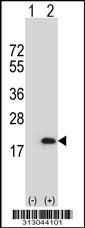 Western blot analysis of his-tag REG1A (arrow) using his tag antibody. 293 cell lysates (2 ug/lane) either nontransfected (Lane 1) or transiently transfected with the REG1A gene