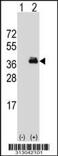 Western blot analysis of his-tag OTX2 (arrow) using his tag antibody. 293 cell lysates (2 ug/lane) either nontransfected (Lane 1) or transiently transfected with the OTX2 gene