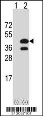 Western blot analysis of his-tag KRT222P (arrow) using his tag antibody. 293 cell lysates (2 ug/lane) either nontransfected (Lane 1) or transiently transfected with the KRT222P gene