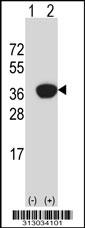 Western blot analysis of his-tag GNMT (arrow) using his tag antibody. 293 cell lysates (2 ug/lane) either nontransfected (Lane 1) or transiently transfected with the GNMT gene