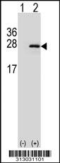 Western blot analysis of his-tag FAM96A (arrow) using his tag antibody. 293 cell lysates (2 ug/lane) either nontransfected (Lane 1) or transiently transfected with the FAM96A gene