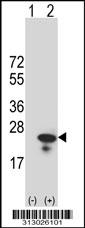 Western blot analysis of his-tag C9orf7 (arrow) using his tag antibody. 293 cell lysates (2 ug/lane) either nontransfected (Lane 1) or transiently transfected with the C9orf7 gene