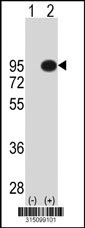Western blot analysis of his-tag BAP1 (arrow) using his tag antibody. 293T cell lysates (2 ug/lane) either nontransfected (Lane 1) or transiently transfected with the BAP1 gene‘