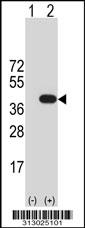 Western blot analysis of his-tag C9orf100 (arrow) using his tag antibody. 293 cell lysates (2 ug/lane) either nontransfected (Lane 1) or transiently transfected with the C9orf100 gene