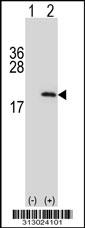 Western blot analysis of his-tag C20orf7 (arrow) using his tag antibody. 293 cell lysates (2 ug/lane) either nontransfected (Lane 1) or transiently transfected with the C20orf7 gene