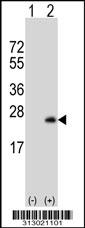 Western blot analysis of his-tag BTG1 (arrow) using his tag antibody. 293 cell lysates (2 ug/lane) either nontransfected (Lane 1) or transiently transfected with the BTG1 gene
