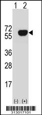 Western blot analysis of his-tag PDHA2 (arrow) using his tag antibody. 293 cell lysates (2 ug/lane) either nontransfected (Lane 1) or transiently transfected with the PDHA2 gene