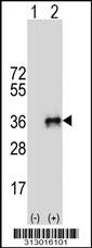 Western blot analysis of his-tag PDGFB (arrow) using his tag antibody. 293 cell lysates (2 ug/lane) either nontransfected (Lane 1) or transiently transfected with the PDGFB gene